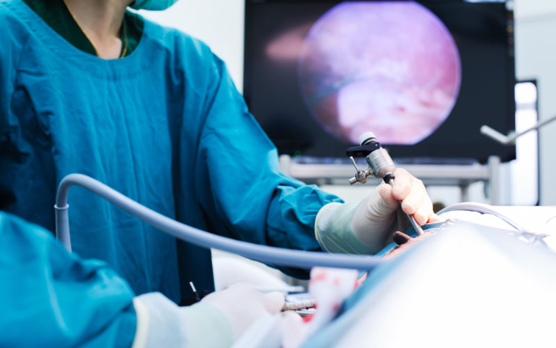 servicios-cirugia-laparoscopica-03