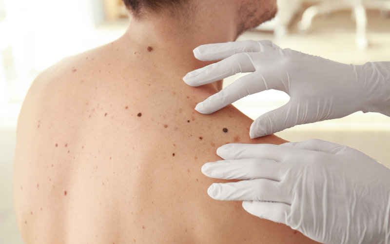 servicios-dermatologia